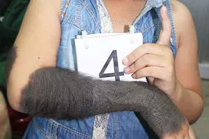 Bị trời phạt nên có cánh tay vượn? 