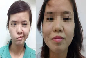 Cô gái 20 năm mới dám cười