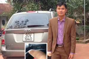 Cụt 1 bàn tay có được phép học lái ô tô?