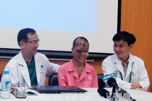 Phẫu thuật khối u khổng lồ trên mặt cô gái 21 tuổi