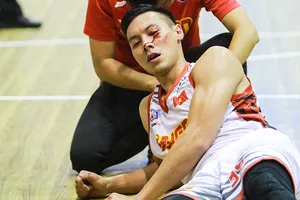 VBA ‘ứng xử’ với bạo lực