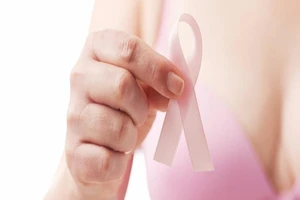 Phát động chiến dịch tầm soát ung thư vú