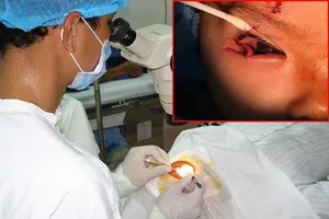 Mẹ lắc vòng, con hư mắt 