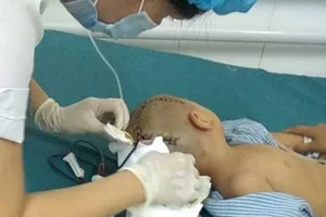 Bé 3 tuổi bị chấn thương sọ não ở trường mầm non