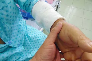 Tái tạo dương vật mới cho khổ chủ