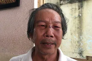 Lời kể của ông lão bị bảo vệ chung cư hành hung dã man