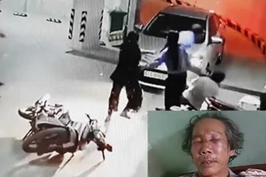 Điều tra bảo vệ chung cư đánh người nhập viện