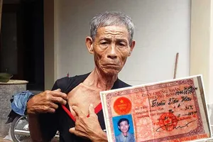 Mảnh đạn găm trong phổi vẫn bị xem thương binh giả
