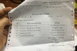 Thú cưng gây bệnh nguy hiểm không ngờ