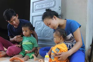 Cuộc sống mới của 2 bé dính nhau vùng cụt