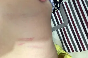 Con bị đánh, cha đề nghị trường bồi thường… 100 triệu đồng