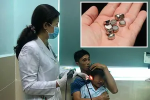 Cảnh báo trẻ bị thủng mũi, màng nhĩ từ pin đồ chơi