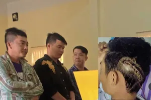 Chém nứt sọ người khác, xử tội gì?