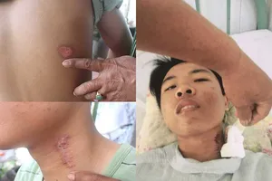 Nam thanh niên tố bị CSGT bắn gây thương tích