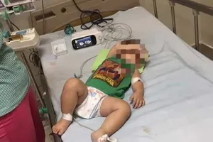 2 anh em ruột tử vong do bệnh Whitmore