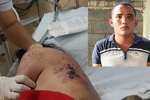 Chủ quán cà phê kích dục đánh tiếp viên nhập viện