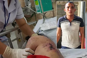 Lời khai kẻ đánh nữ nhân viên từ chối kích dục