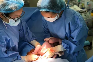 Truyền máu song thai không cần phải ra nước ngoài