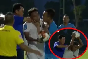 Khổ với bóng đá xấu xí