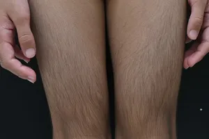 Bé gái mắc bệnh hiếm, thế giới chỉ có 74 ca