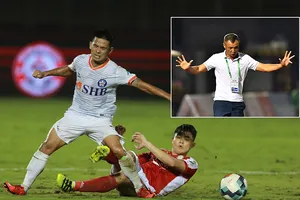 VPF rối và nỗi lo há miệng mắc quai