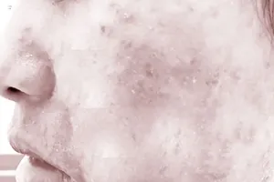 Làm đẹp, chưa đẹp đã vào bệnh viện