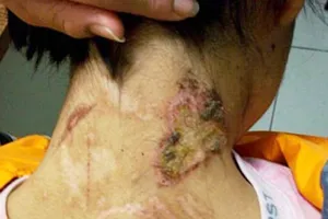 Giải thoát cô gái bị bắt làm nô lệ suốt hai năm trời