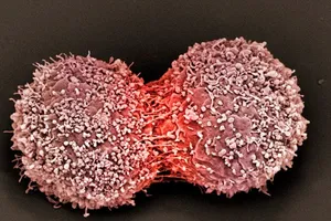 Tìm ra phương pháp chữa ung thư mới bằng hệ miễn dịch