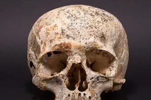 Giải mã tục bó đầu kỳ lạ từ gương mặt người chết 3.700 trước