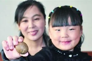 Phát hiện viên sỏi cực quý trong gan cừu