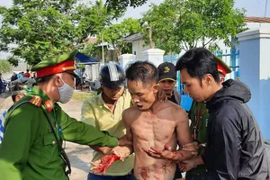 Ngáo đá, thanh niên dùng dao tự cắt tay mình