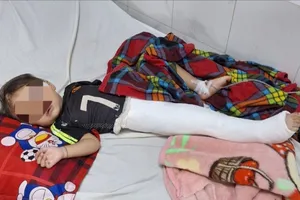 Thông tin mới vụ cháu trai 2 tuổi nghi xe máy tông gãy chân 