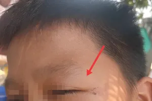  Công an TP Buôn Ma Thuột thụ lý vụ 5 cháu nhỏ bị đánh