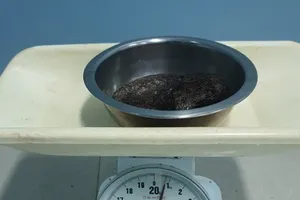 Mổ cấp cứu bé gái mắc bệnh nghiện ăn tóc, lấy búi tóc to ở dạ dày