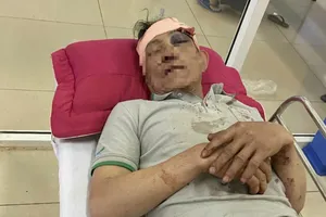 2 nông dân tranh chấp nguồn nước tưới: 1 người mù mắt, 1 người bị phạt tù