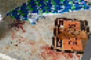 Công an điều tra vụ vợ chém chồng trọng thương