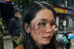 Nữ nhân viên giao hàng tố bị đánh bầm dập vì… chiếc áo bị chật