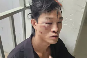 Đi ăn hủ tiếu khuya, thanh niên tỉnh dậy ở trạm xá với nhiều vết thương