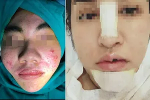 Tết đến, xin vợ đừng quá ham đẹp mà thành họa!