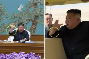 Báo Hàn: Ông Kim Jong-un có thể đã trải qua thủ thuật y tế