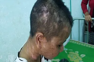 Bộ trưởng Lao động yêu cầu xử nghiêm vụ đánh người làm thuê