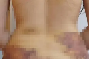 Vụ nghi chồng bạo hành dã man: Khẩn trương điều tra, xác minh