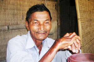 Hy hữu, lão nhân 45 năm chưa hề chợp mắt