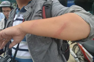 Người đàn ông đuổi đánh các phóng viên tại hiện trường vụ thảm sát ở Bình Phước 