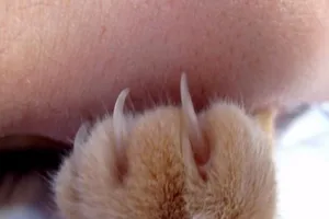 Thanh niên mắc chứng bất lực sau khi bị mèo cào