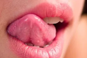 Bệnh lạ: Thấy vị ngọt trong miệng mỗi khi nghe tên sếp