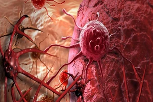 8 quan niệm sai lầm về bệnh ung thư cần từ bỏ ngay