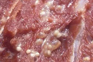 Cục Y tế dự phòng khuyến cáo về bệnh sán lợn