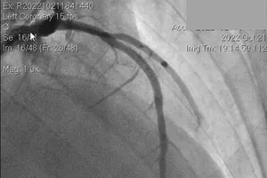2 bệnh viện phối hợp cứu sống bệnh nhân ngưng tim ngưng thở 