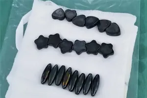 Nuốt 20 viên nam châm vì tưởng là kẹo, bé trai phải cắt bỏ đoạn ruột 15cm